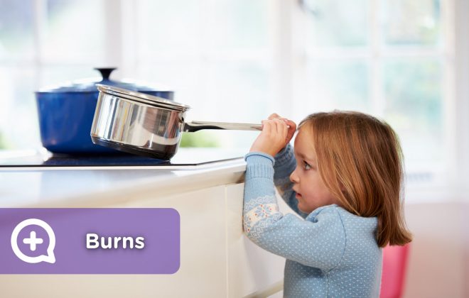 Minor burns in children and adults due to household accidents in the kitchen