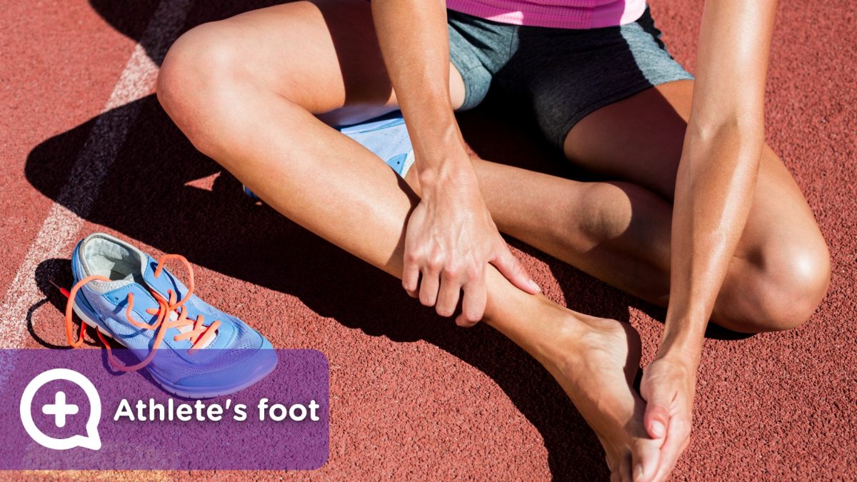 Woman athlete with athlete's foot, foot condition, fungus