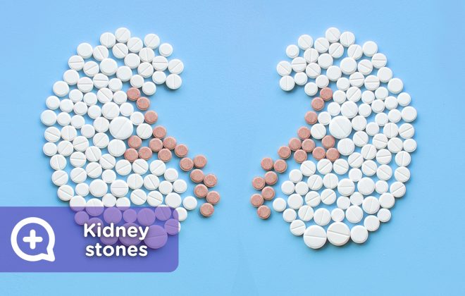 kidney stones, lithotripsy, kidney stones.