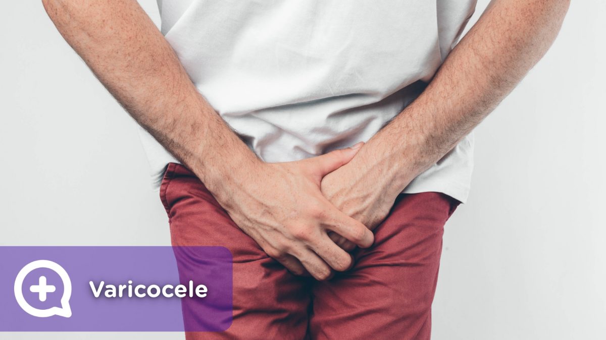 The varicocele is a spermatic cord that is around the testicles, composed of arteries, veins and nerves, which carries blood to the testicles, as well as semen to the vas deferens.