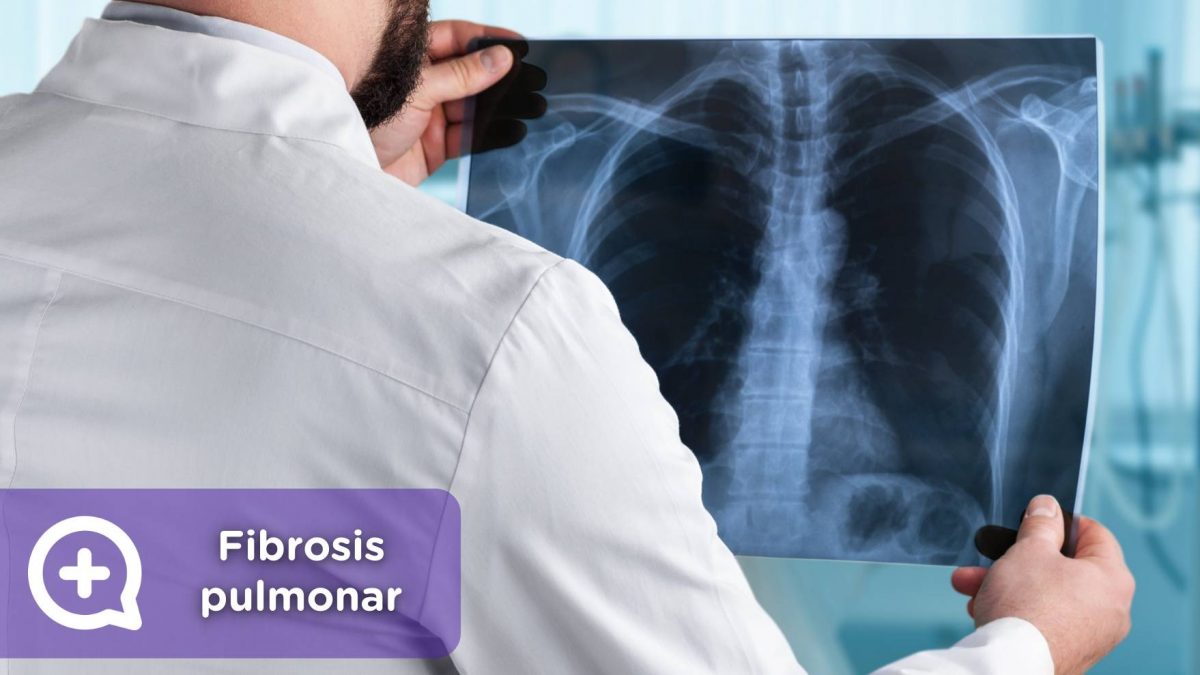 Fibrosis pulmonar, mediquo, Tu amigo médico. Radiografia, respiración. Salud.