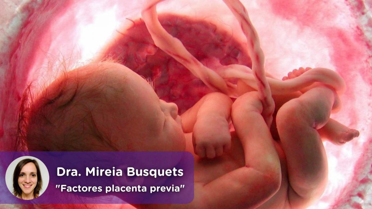 Factores de riesgo de placenta previa. MediQuo, Ginecología. Mireia Busquets. Salud. Embarazo.