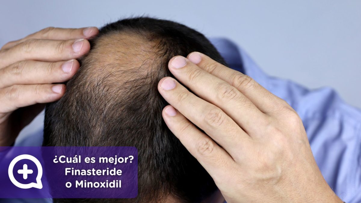 Preguntas frecuentes. Finasteride y Minoxidil. Consulta online dermatología. Clínica Salud Capilar by mediQuo. Alopecia. Receta médica.