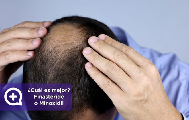 Preguntas frecuentes. Finasteride y Minoxidil. Consulta online dermatología. Clínica Salud Capilar by mediQuo. Alopecia. Receta médica.