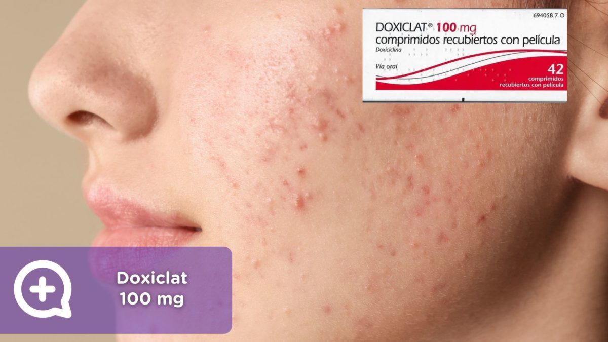 Doxiclat 100 mg. clínica de la piel by mediquo. Tratamiento farmacológico para el acné. Receta.