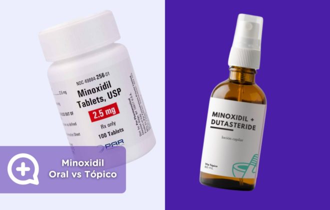 Minoxidil Oral vs Tópico. Consulta online dermatología. Clínica Salud Capilar by mediQuo. Alopecia. Receta médica.