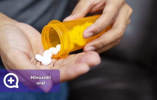 Minoxidil oral. Consulta online dermatología. Clínica Salud Capilar by mediQuo. Alopecia. Receta médica.