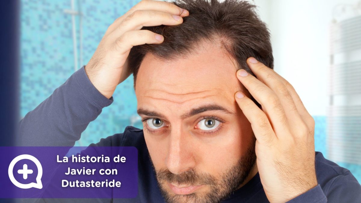 La historia de Javier con Dutasteride + minoxidil. Consulta online dermatología. Clínica Salud Capilar by mediQuo. Alopecia. Receta médica.