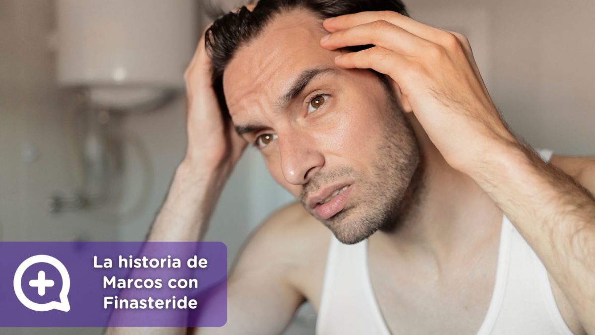 La historia de Marcos con Finasteride + minoxidil. Consulta online dermatología. Clínica Salud Capilar by mediQuo. Alopecia. Receta médica.