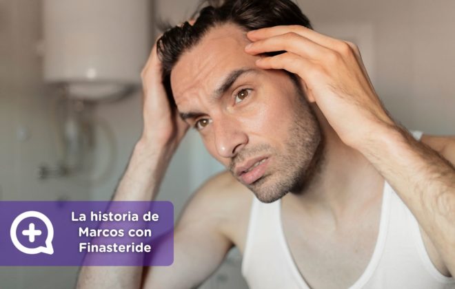 La historia de Marcos con Finasteride + minoxidil. Consulta online dermatología. Clínica Salud Capilar by mediQuo. Alopecia. Receta médica.