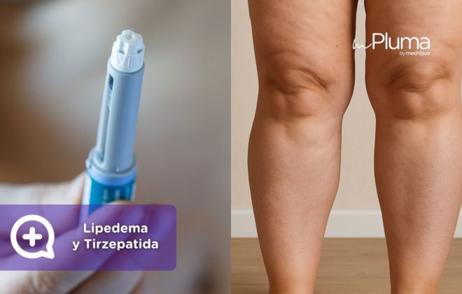 Lipedema y tirzepatida síntomas, tratamiento y nuevas esperanzas para las pacientes en España